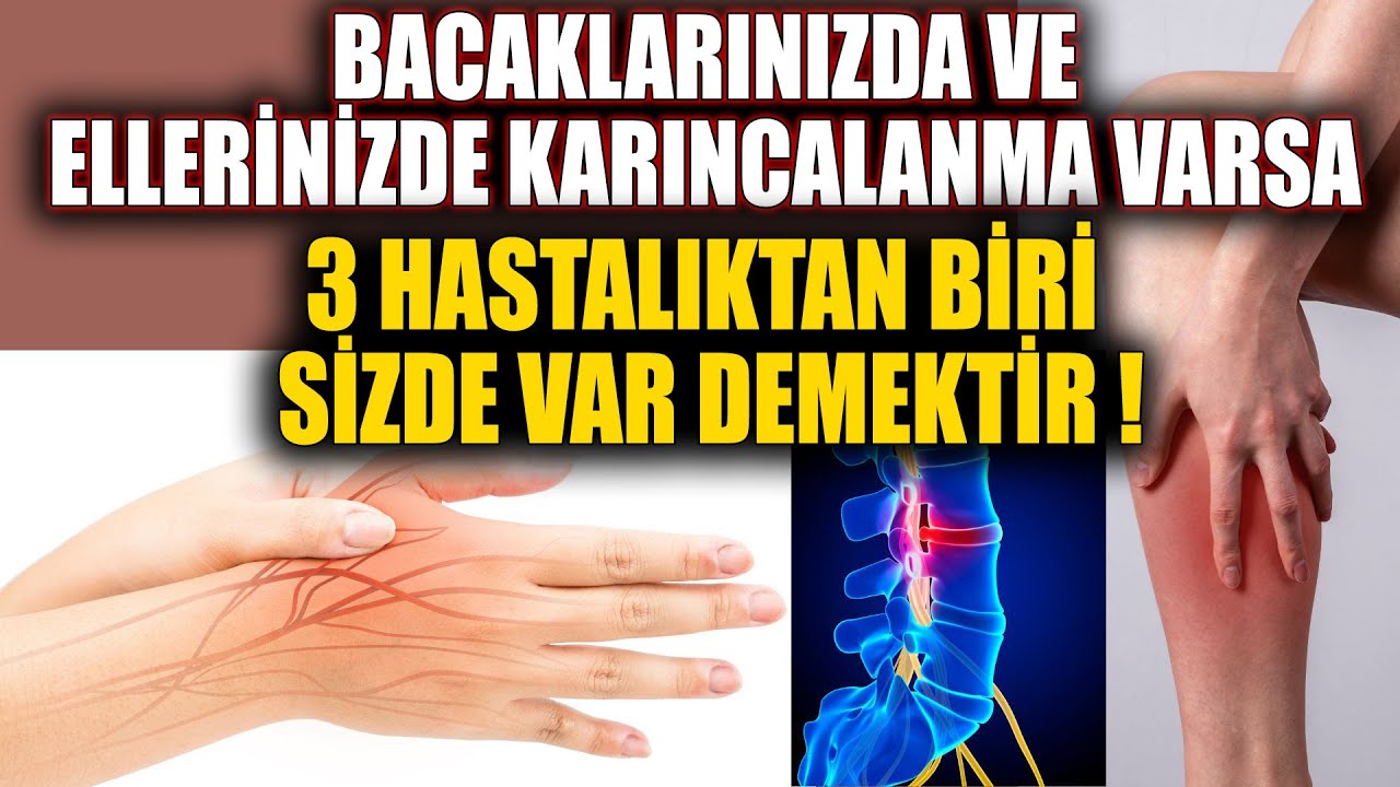 Bacaklarınızda ve Ellerinizde Karıncalanma Varsa, 3 Hastalıktan Biri Sizde Var Demektir !
