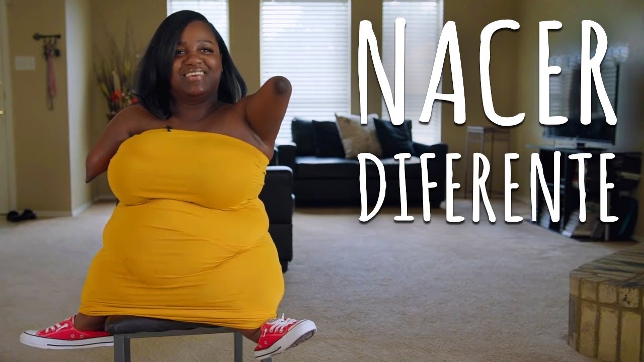 Vivo sin manos y soy muy Feliz | Nacimos Diferentes - truly en español