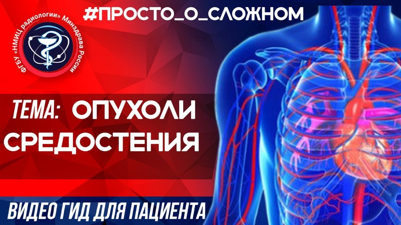 #ПРОСТО_О_СЛОЖНОМ ОПУХОЛИ СРЕДОСТЕНИЯ