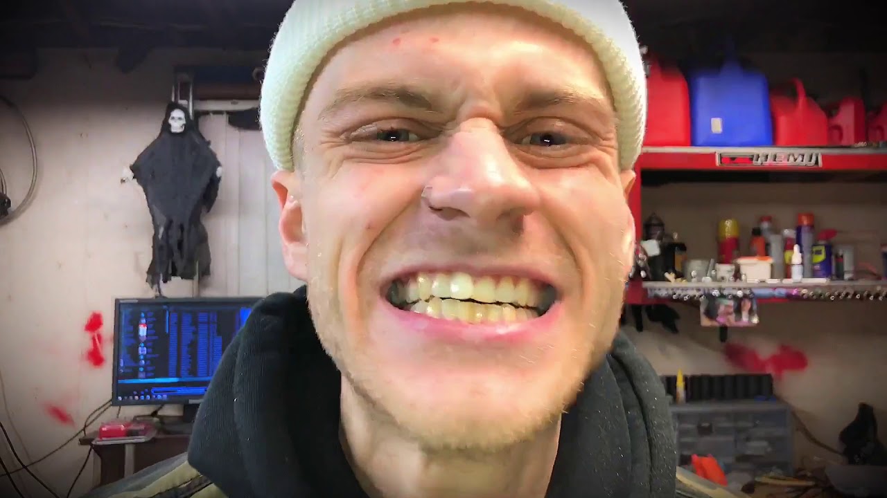 Shiny Smile Veneers (THE BEST SNAP ON VENEERS FOR THE BEST PRICE) - short review
