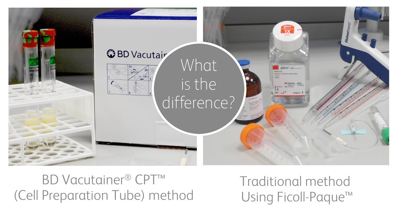 Isoler les PBMC : tubes CPT ou Ficoll-Paque ?