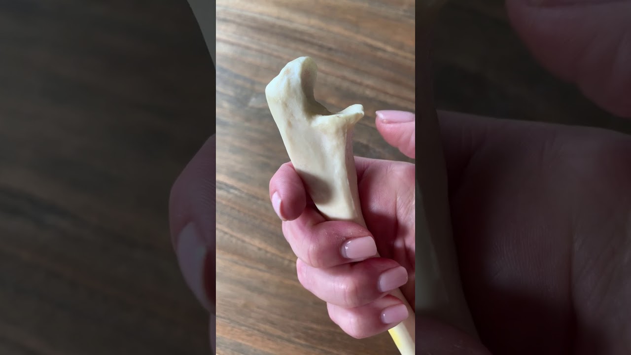 Dr. Biel's Anatomy Bones Quick Review Ulna Video