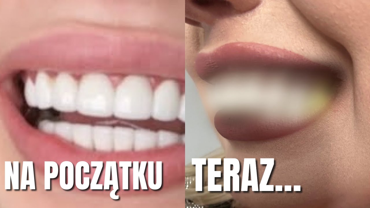 MASAKRYCZNY PROBLEM Z ZĘBAMI…