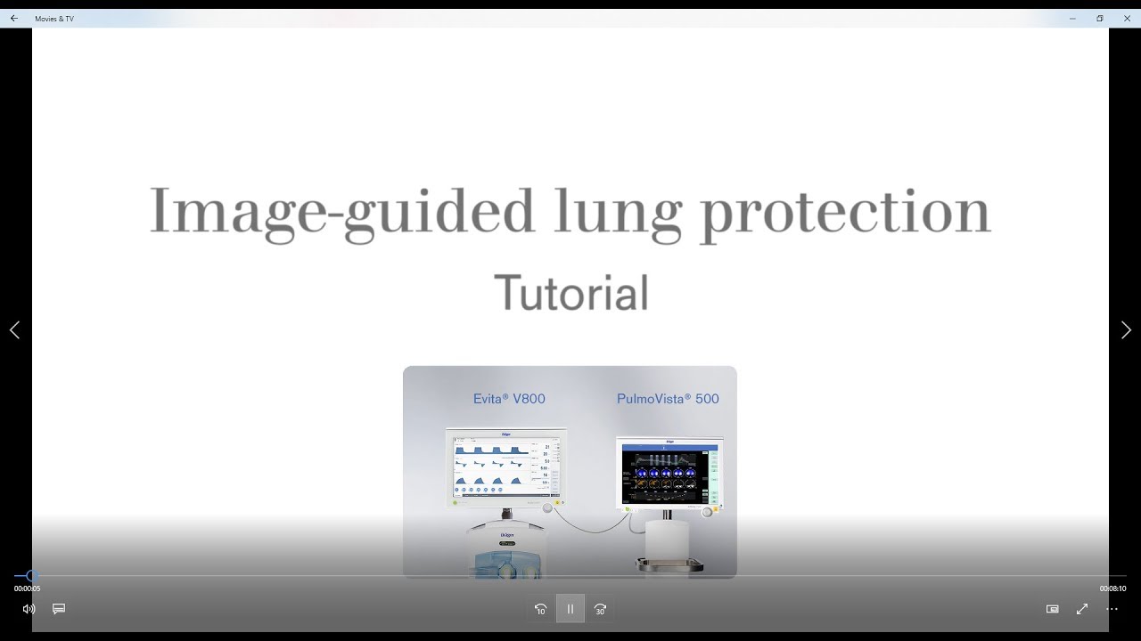Image-guided lung protection with Dräger - Tutorial