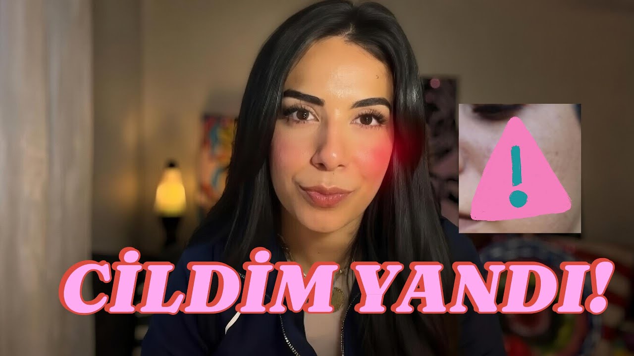 Cildim Yandı! Fraksiyonel Lazer Faciası (Pandemiden Bir Gün Önce 😅)