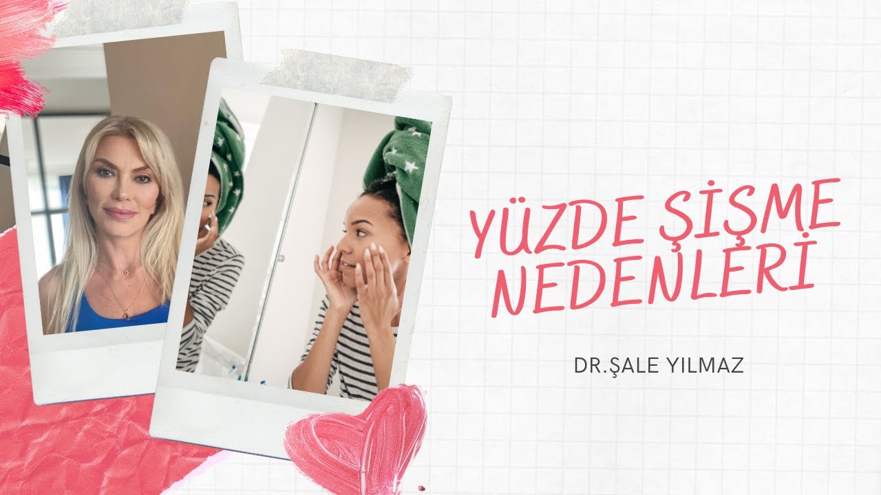 YÜZDE ŞİŞME NEDENLERİ VE ÇÖZÜMLERİ  Dr ŞALE YILMAZ