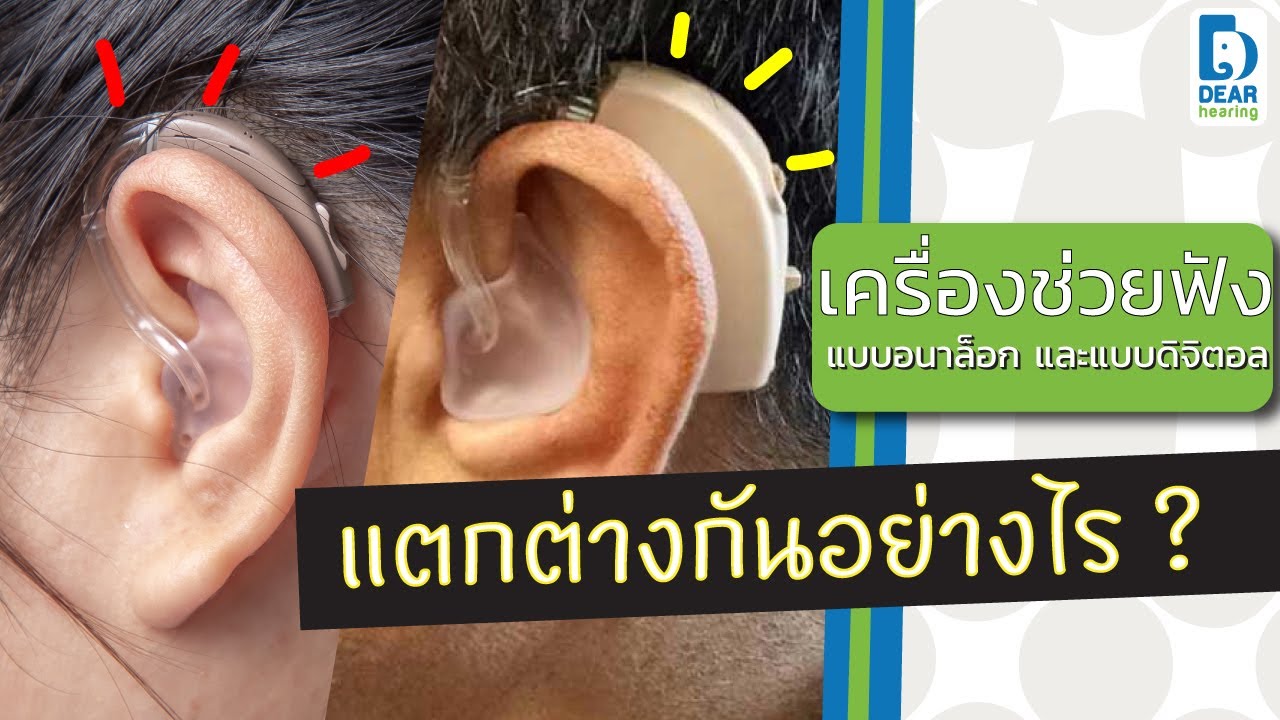 ต่างกันแค่ไหน ??? กับเครื่องช่วยฟังแบบอนาล็อกและแบบดิจิตอล