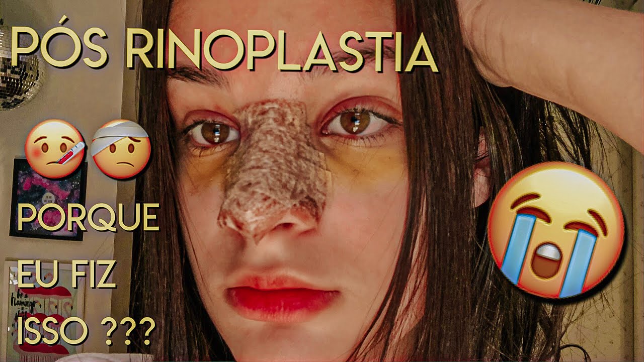 como é a recuperação de uma *rinoplastia* 💉😭