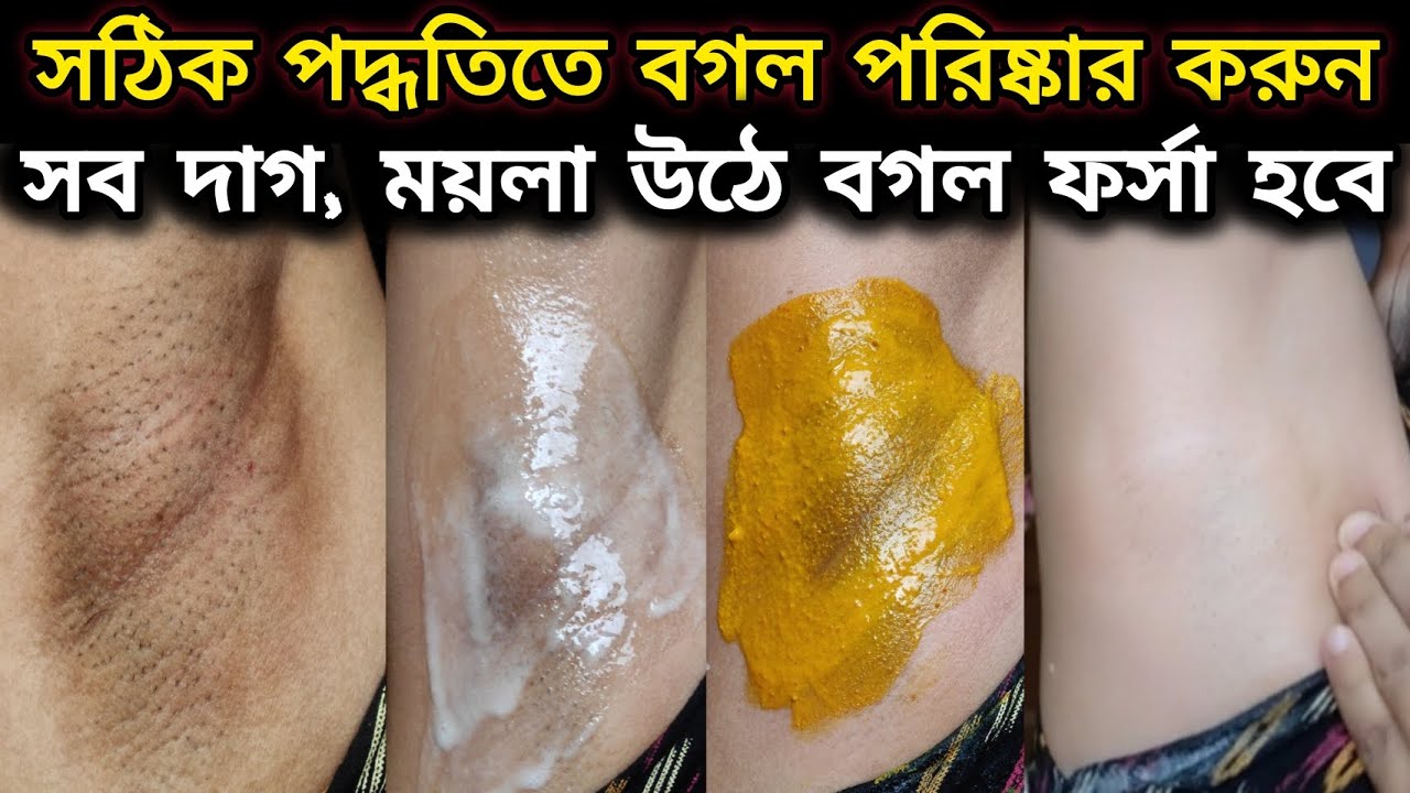 বগলের ময়লা ও কালো দাগ তুলে বগল পরিষ্কার করার সহজ উপায় | 100% Clean Fair Underarm⚡