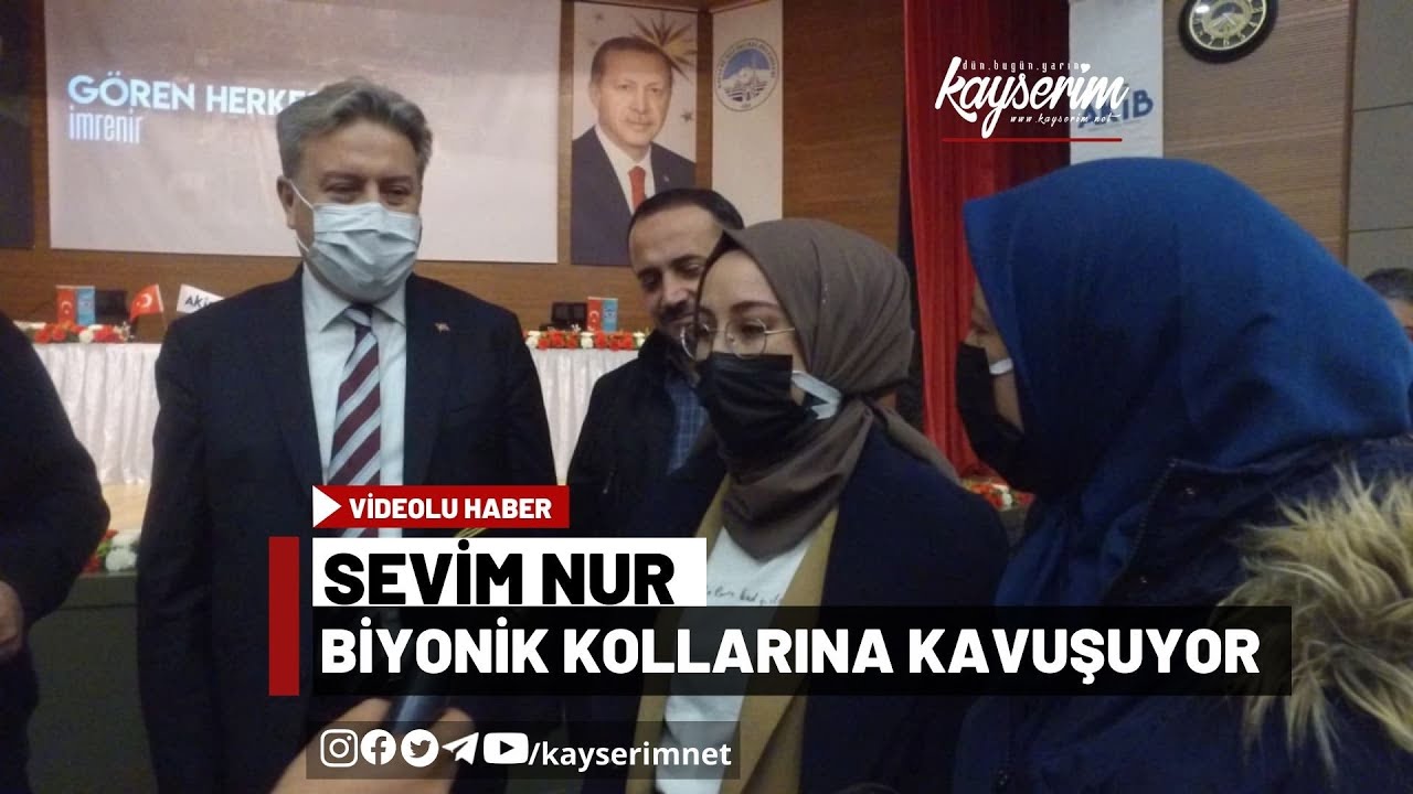 Sevim Nur Biyonik Kollarına Kavuşuyor