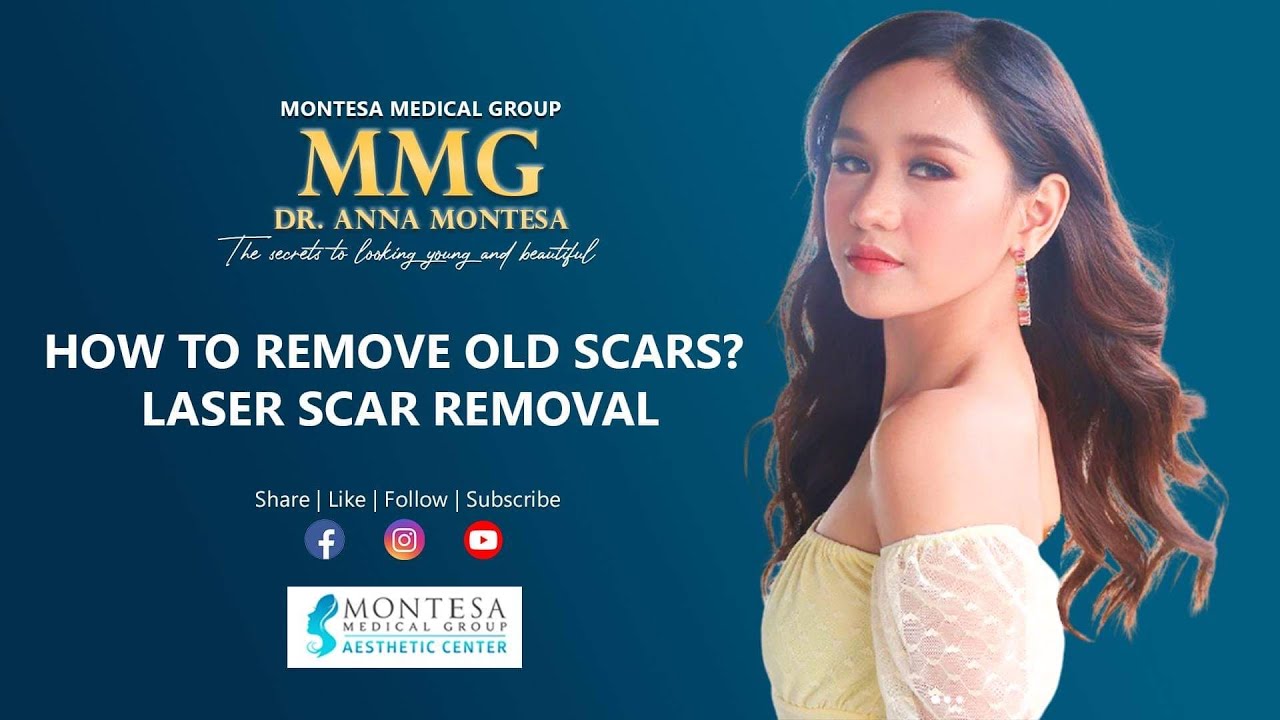 HOW TO REMOVE OLD SCARS ON LEGS? HOW TO REMOVE PIMPLES?