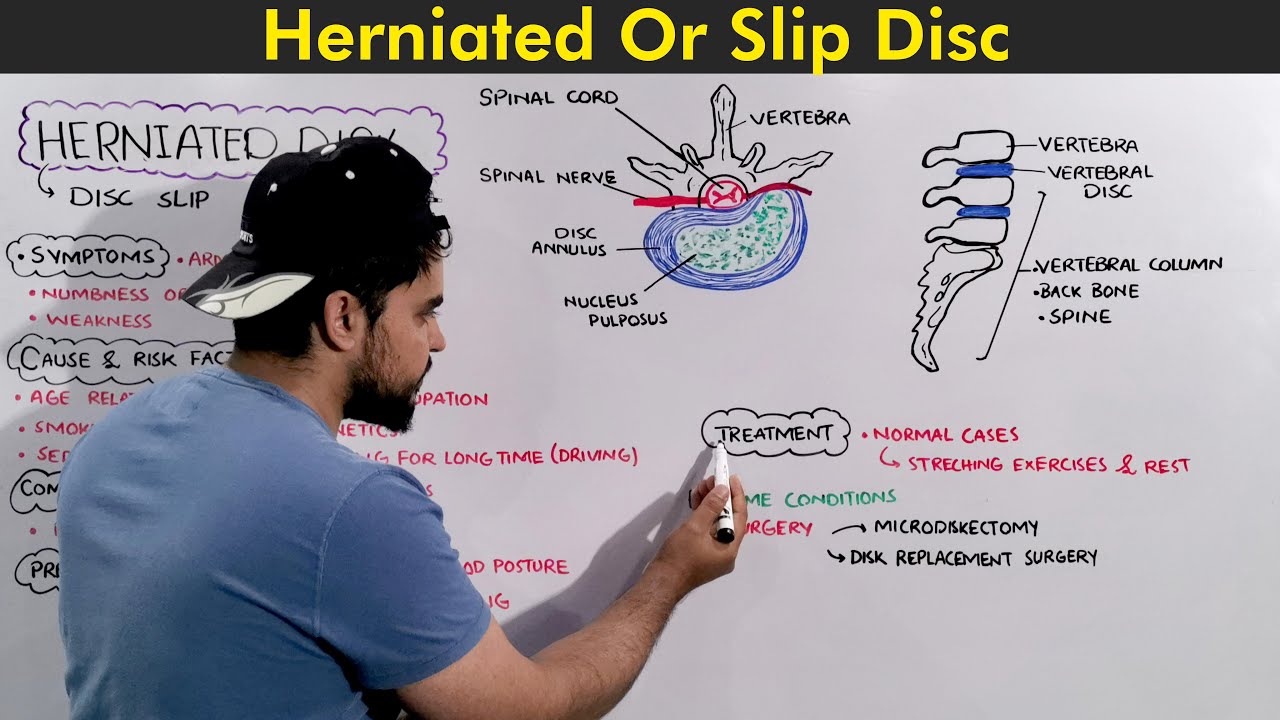 Herniated Disc / Slip Disc: Symptoms, Causes, and Treatments