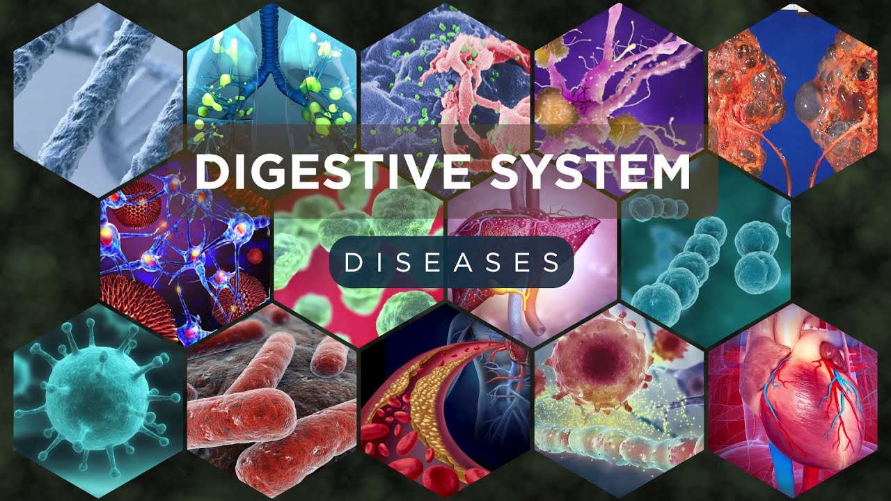 Digestive Diseases Explained - Causes, Symptoms, & Treatments