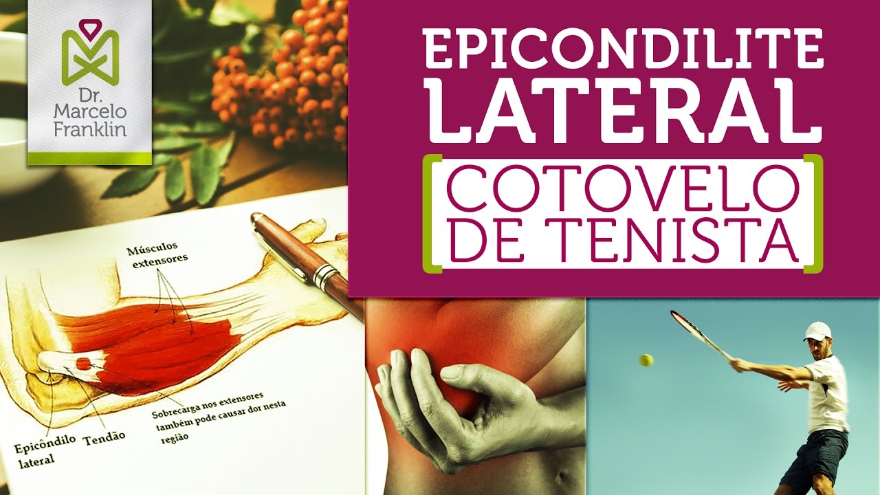 Epicondilite Lateral
