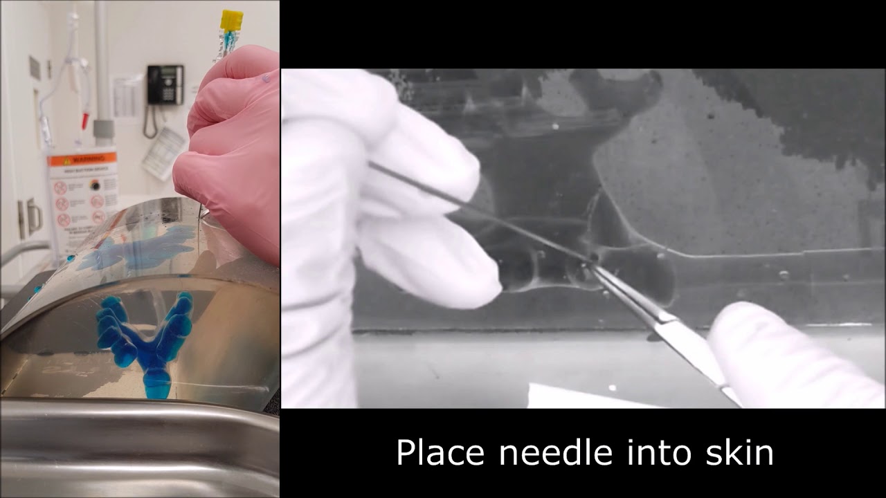 PCNL- Bullseye technique instructional video