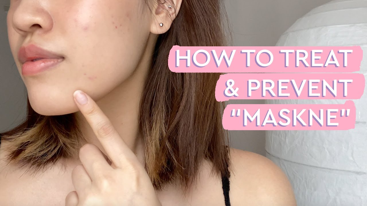 How to Treat And Prevent Maskne (Mask Acne) | Glow Recipe