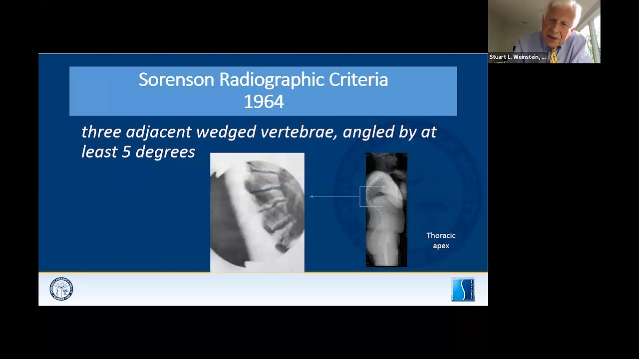 SRS Patient Webinar: Bracing for Spine Deformity