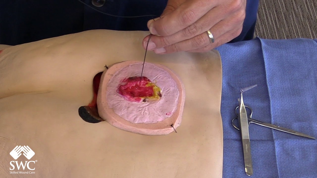 Suture- Figure of 8 Hemostatic