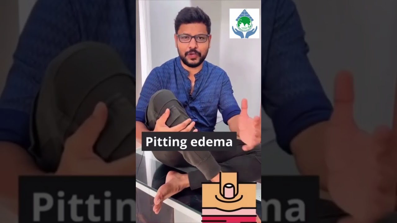 Foot swelling # one minute exercise # trending reels# youtubeshorts