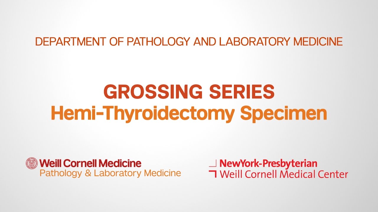 Grossing Hemi-Thyroidectomy Pathology Specimens | Department of Pathology and Laboratory Medicine
