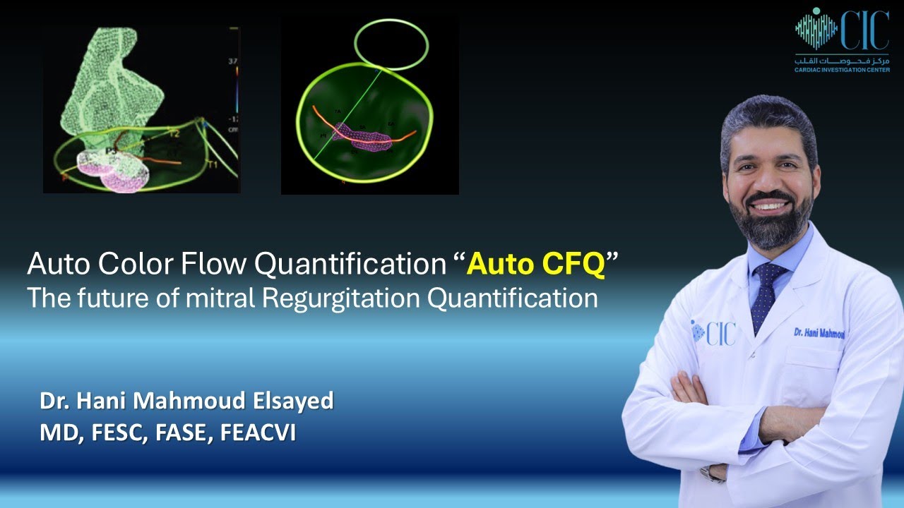 Automated Color Flow Quantification 