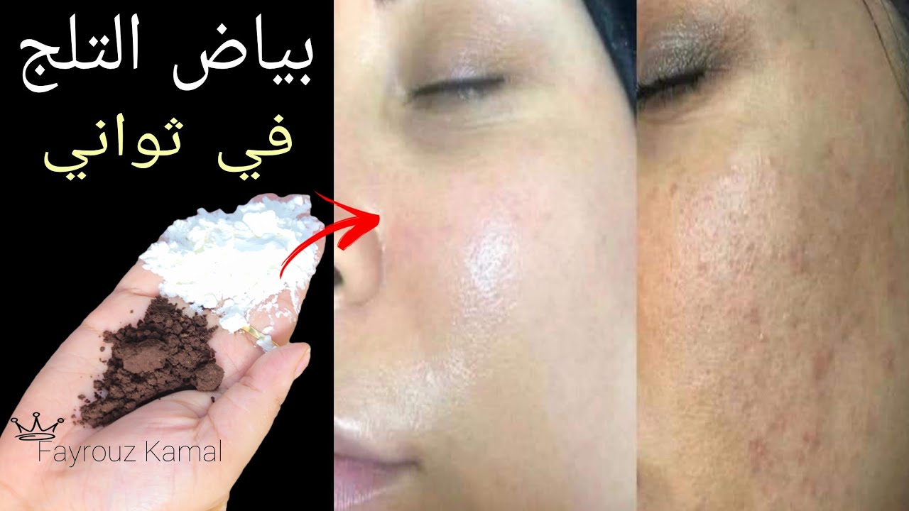 القهوة والنشا🍃 ستجعلكِ بنت 16 سنة مهما كان عمركِ فوق 40! بشرة بدون هالات أو تجاعيد.