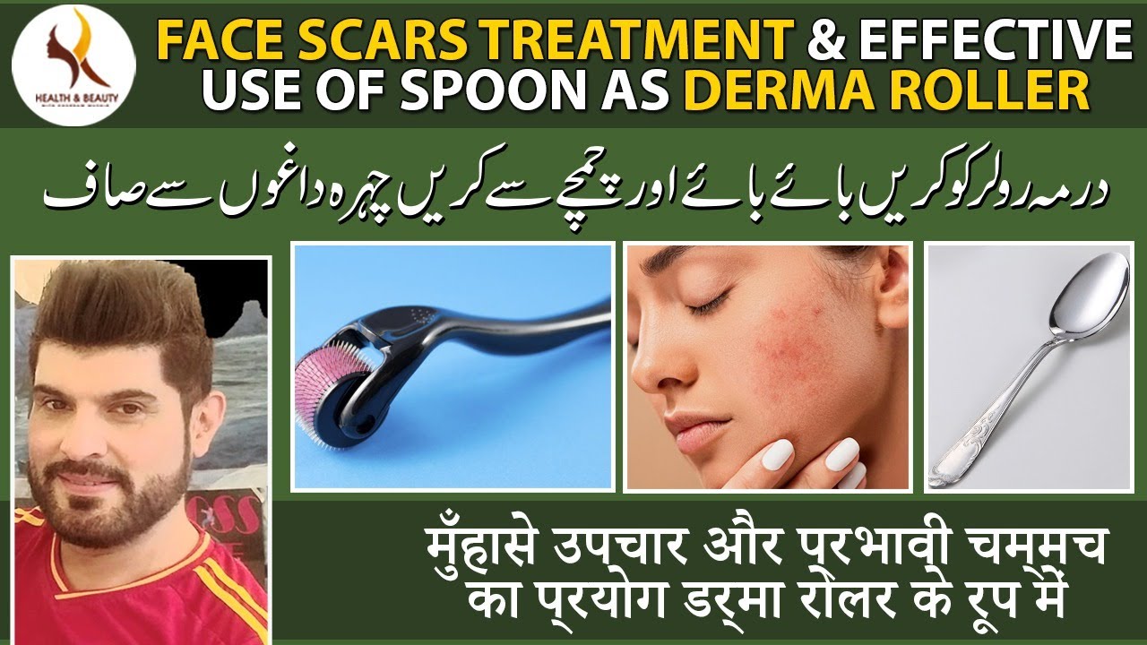 Face scars treatment & Effective use of spoon as derma roller | 100% healer | Dr. Khurram Mushir