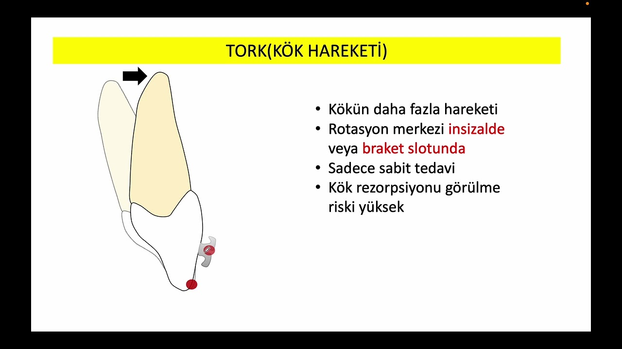 dusakademisi.com ORTODONTİ Paketi Diş Hareketi Konu Anlatımı