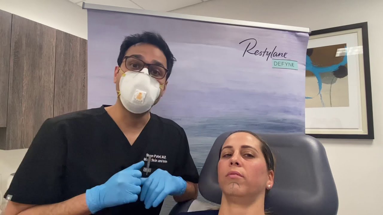Chin filler treatment using Restylane Defyne to treat a recessed chin - Dr. Shaun Patel in Miami, FL