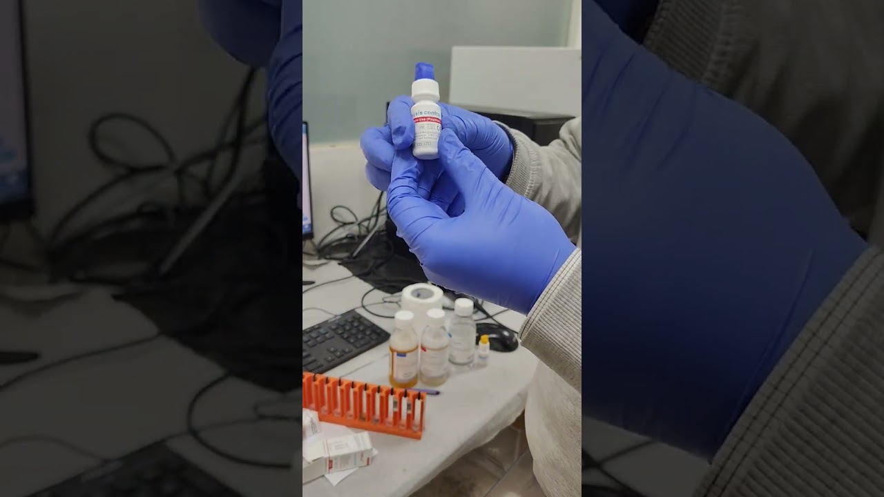 FUS 2000 Best Fully Auto Analyzer for Urine Routine & Microscopy 