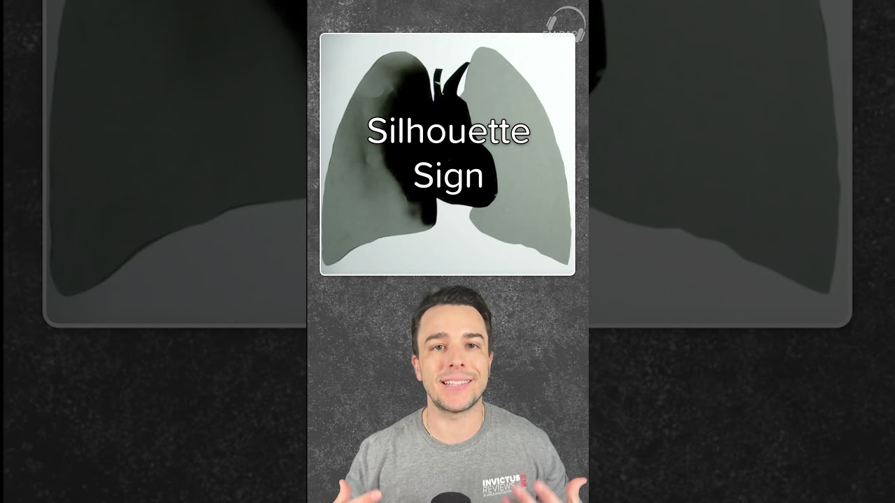 Silhouette Sign in Chest X-Rays