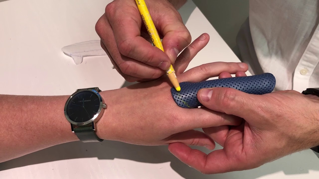 Dorsal Finger Splint by ATS
