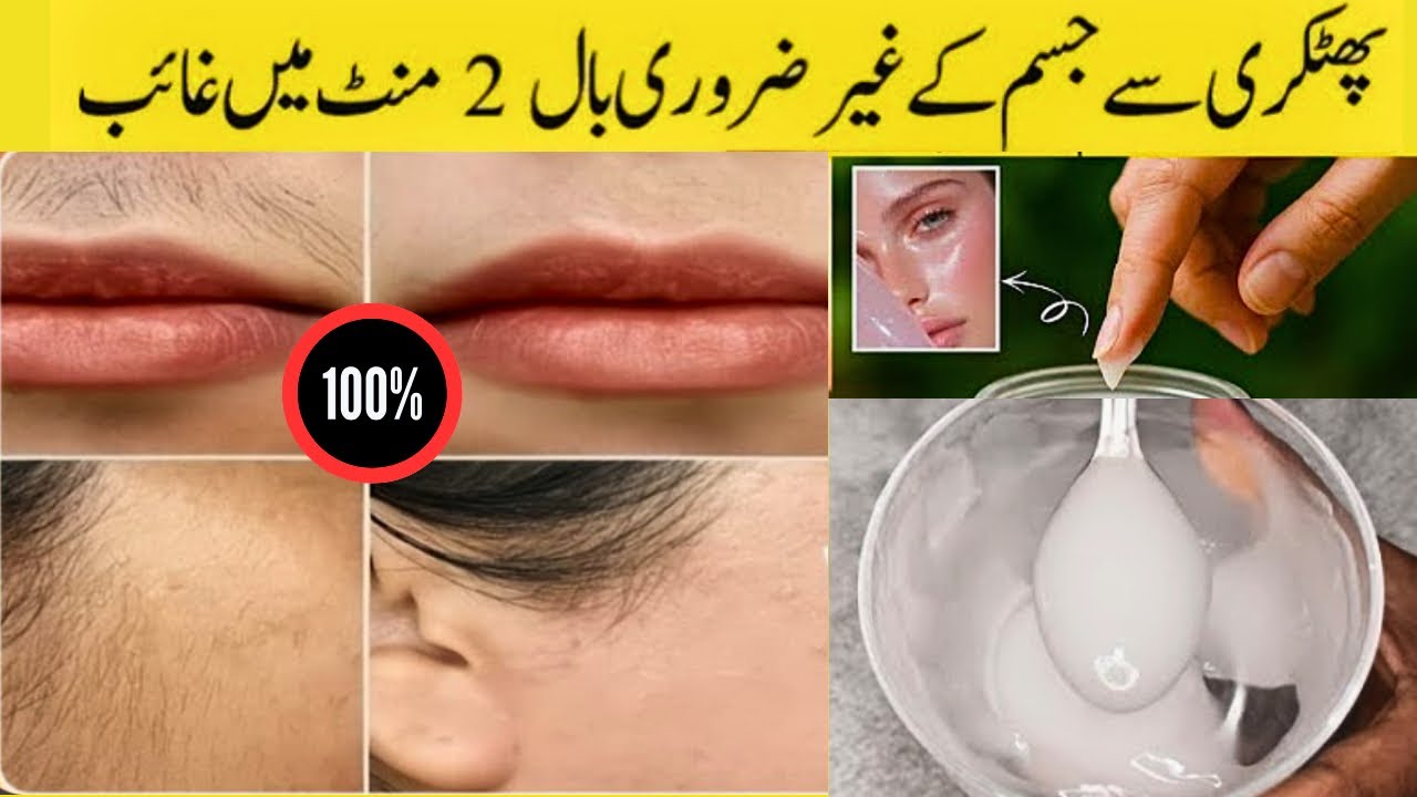 Fitkari for Unwanted Facial Hair removal permenantly😳How To Remove facial hair at home | Home Remedy