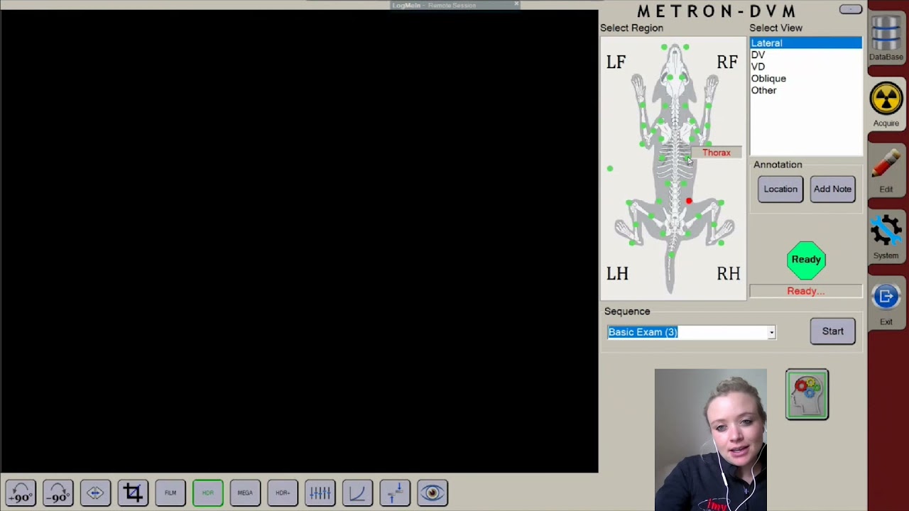ClaroX DR System Software: Acquiring an image and Selecting projections - video 2