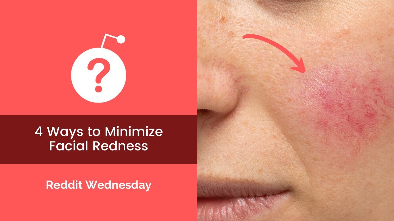 4 Genius Ways to Reduce Facial Redness