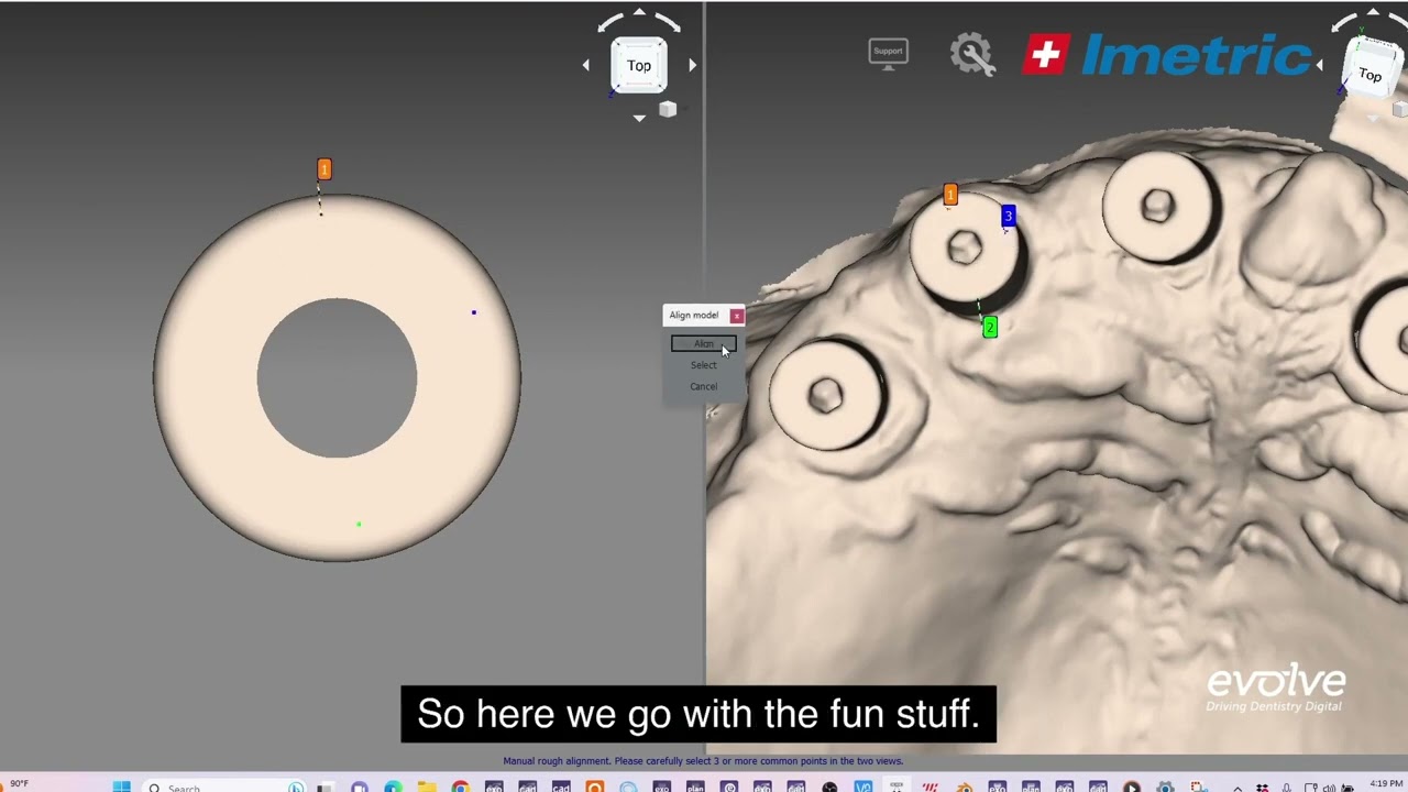 Matching Icam 4D data in the Iscan 3d dental software