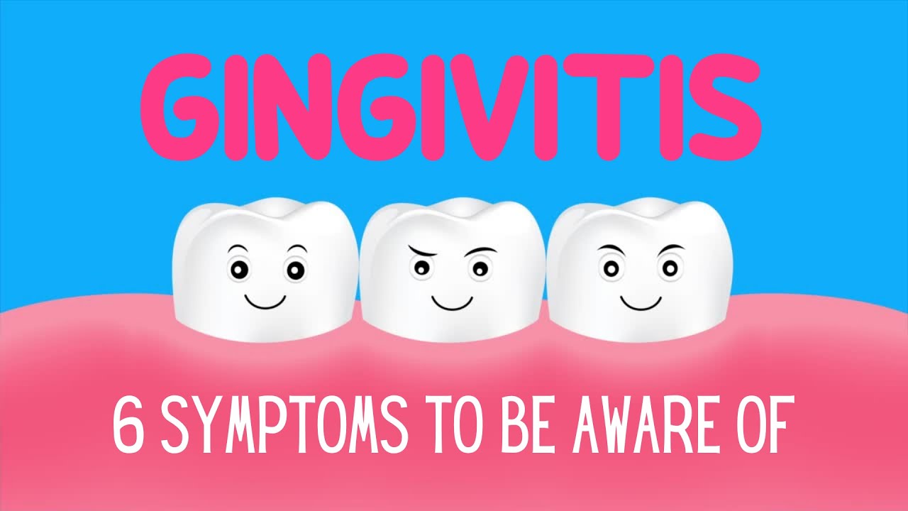 GINGIVITIS: 6 Symptoms to be aware of