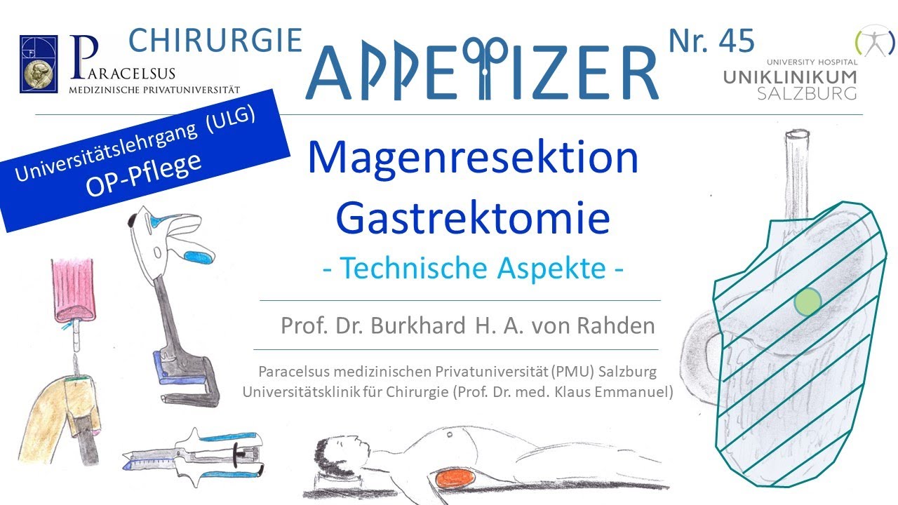 Magenresektion Gastrektomie CHIRURGIE APPetizer Nr. 45 FINAL OP-Pflege Nr. 1