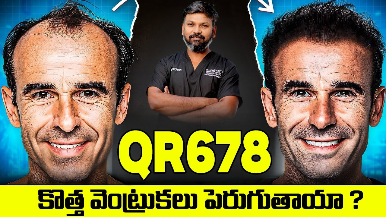 #AskDrJohnWatts | QR678 కొత్త వెంట్రుకలు పెరుగుతాయా ? | Hair Specialist Explains