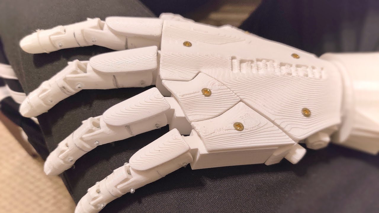 Multiple Gestures with EMG Prosthetic Hand