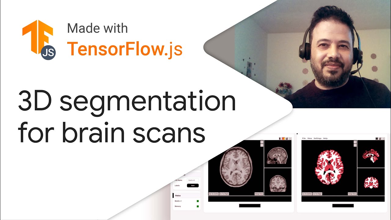 3D MRI brain segmentation - Made with TensorFlow.js