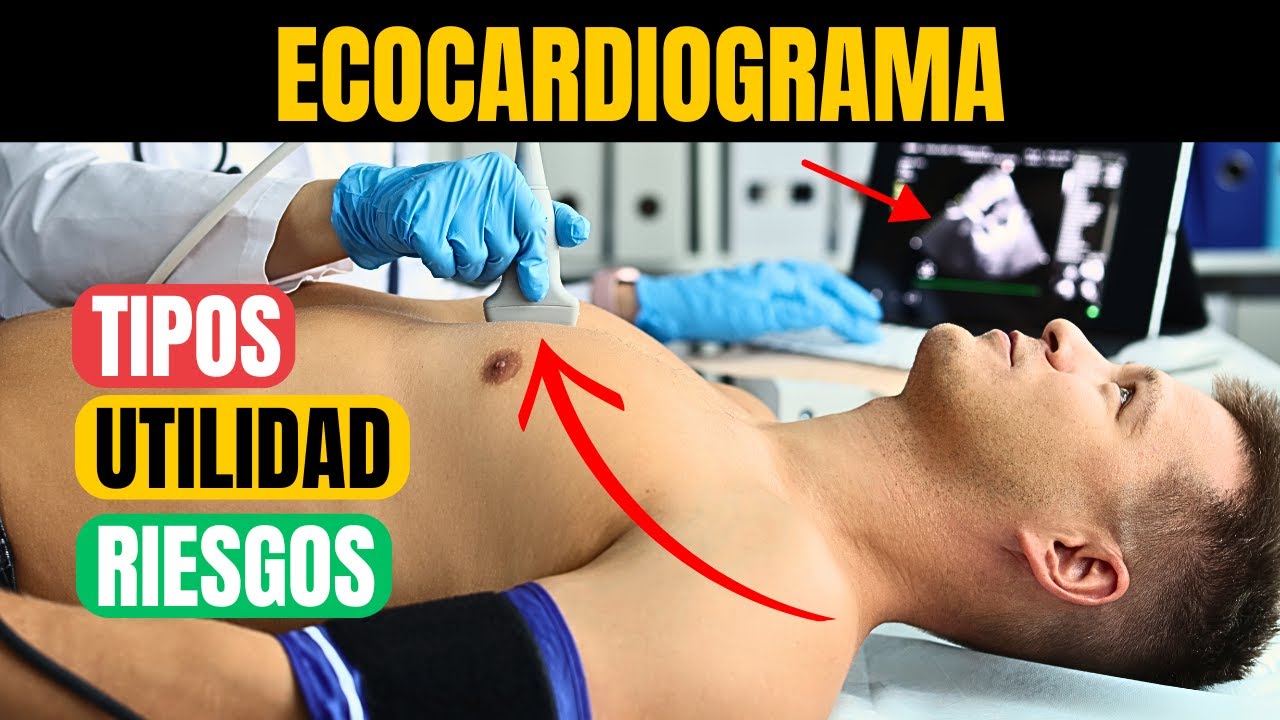 Qué es un Ecocardiograma, Tipos y qué Revela Sobre tu Corazón
