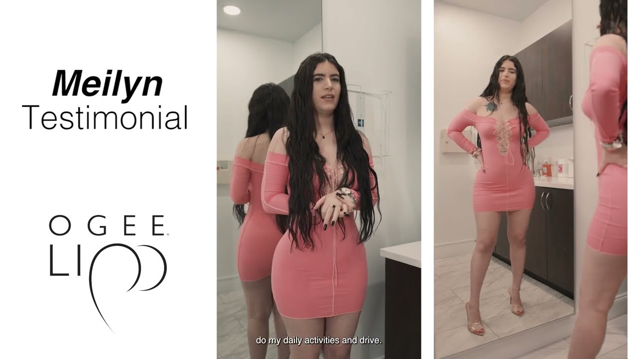 BBL Patient Testimonial - Meilyn