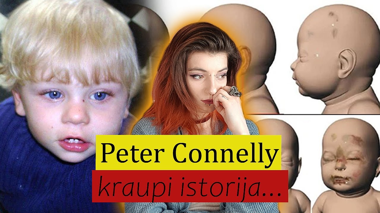 Niekas NEKALTAS?! 17-os mėn vaikas mirė nuo daugiau nei 50-ies sužalojimu ... | Baby P istorija.