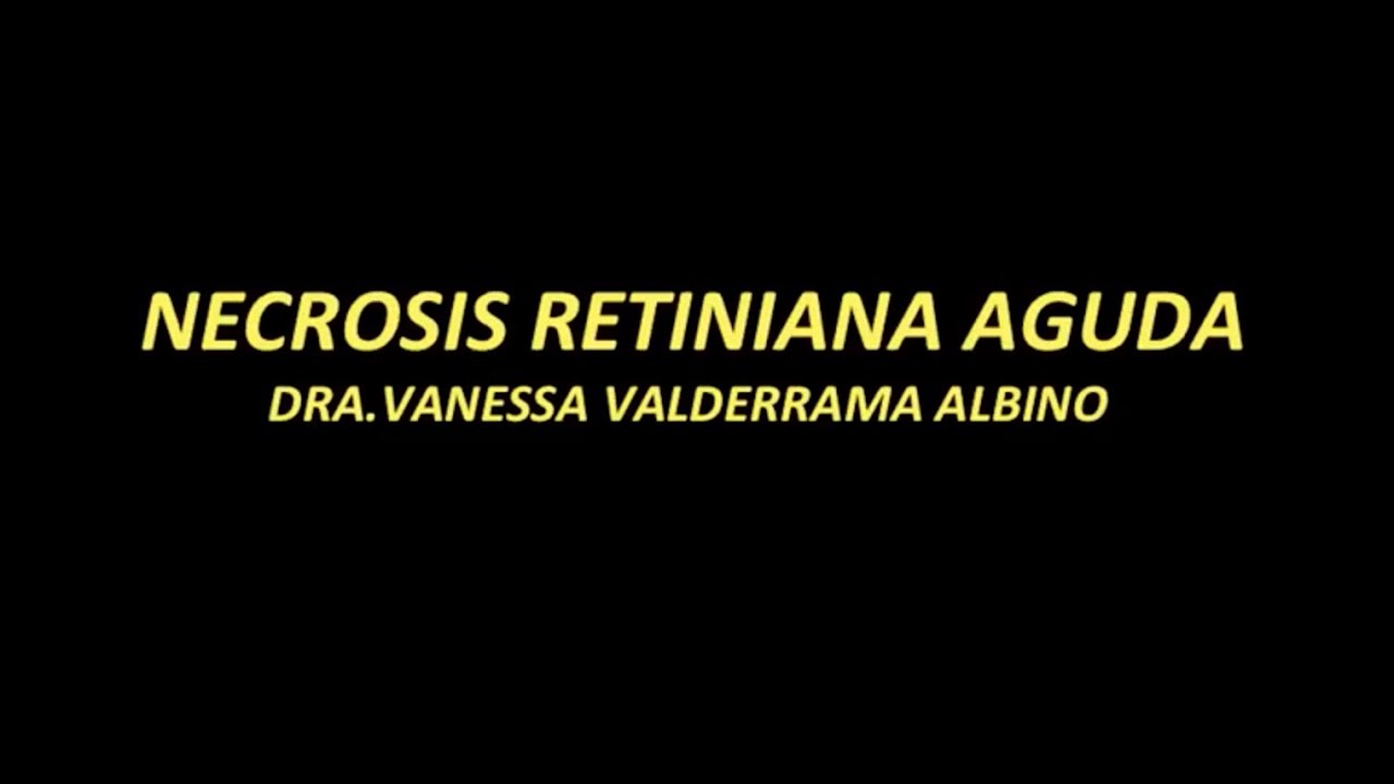 Necrosis Retiniana Aguda. Dra Valderrama Dra Quispe
