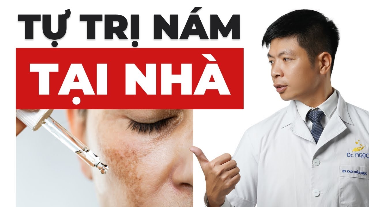 Tự điều trị nám tại nhà làm sao để đạt hiệu quả cao? | Dr Ngọc