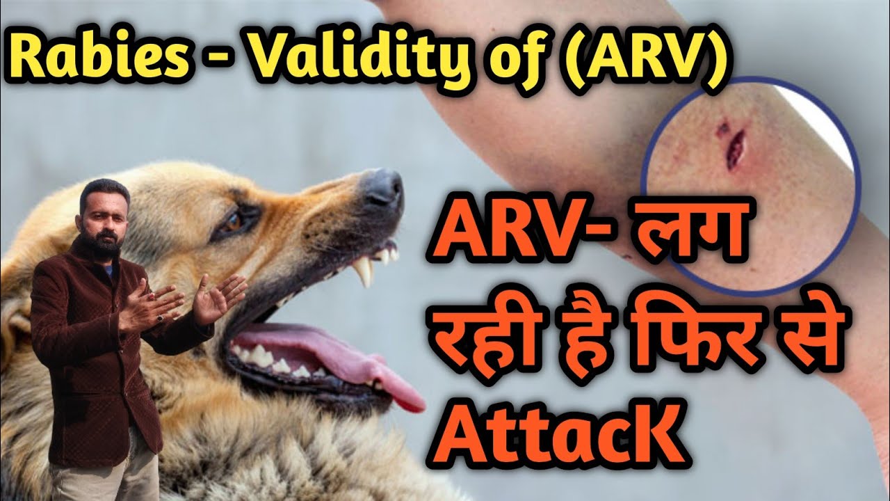 Dog Bite Again During Anti Rabies Vaccine Course &ndash; What To Do?