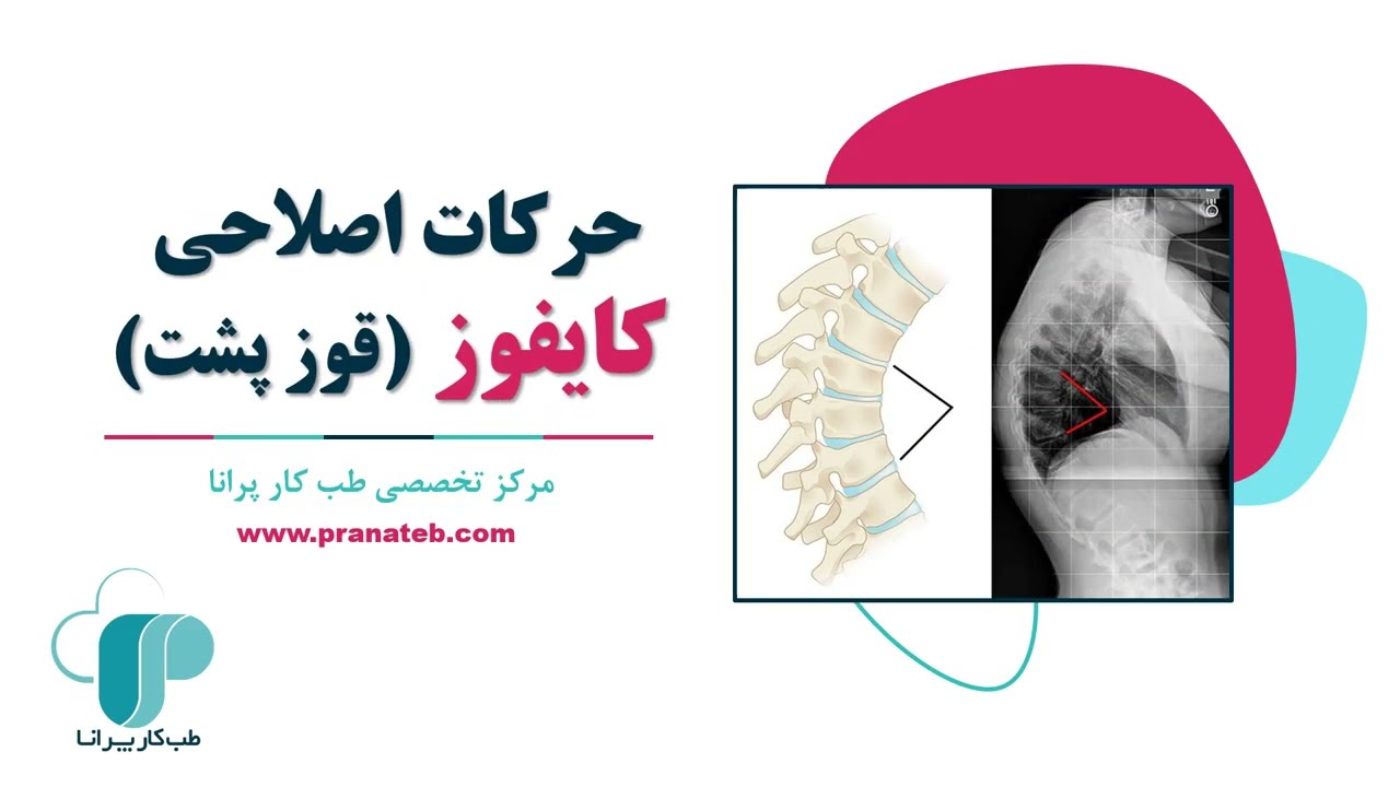 (قوز پشت)حرکات اصلاحی کایفوز