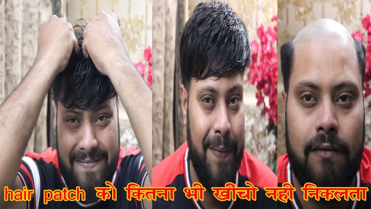 Best hair patch service  | in my center | by delhi hair fixing | call now – 9873152223