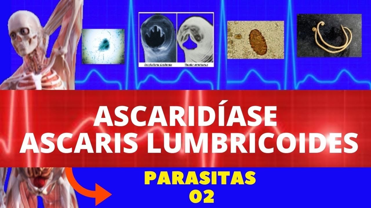 ASCARIDÍASE - ASCARIS LUMBRICOIDES (LOMBRIGA) - PARASITOLOGIA | INFECTOLOGIA